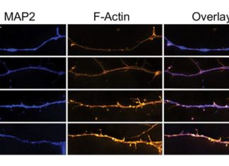 Psychedelics Are Good for Neuroplasticity in Rats. What About Humans?