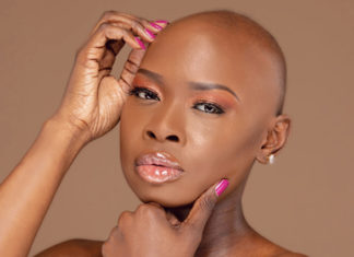 Living with Alopecia Areata